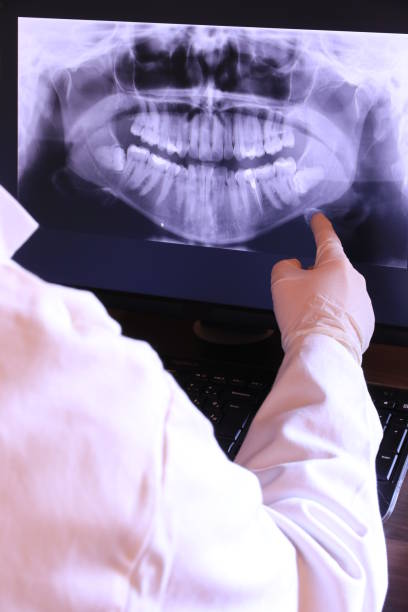Best Dentist for Severe Toothache  in Reeds Spring, MO