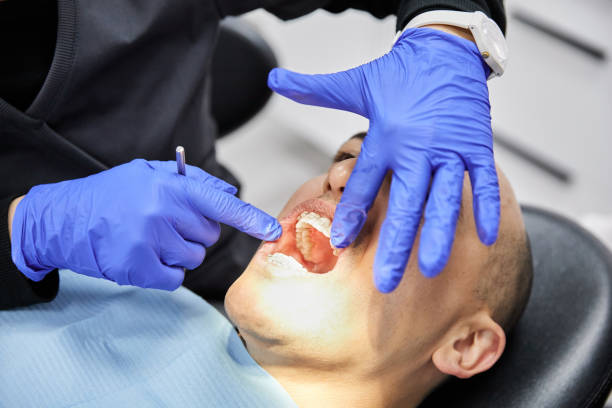 Best Chipped Tooth Repair Near Me  in Reeds Spring, MO